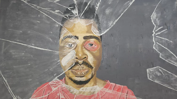 Portrait-style mural of a man wearing a pink/red shirt, looking directly at the viewer with a visibly bruised, reddened eye and a bandage on his forehead. The image is painted with a fractured, shattered-glass overlay effect across the face and background, giving a cracked or broken appearance. The mood is somber, rendered in muted grey tones apart from the skin and injury.