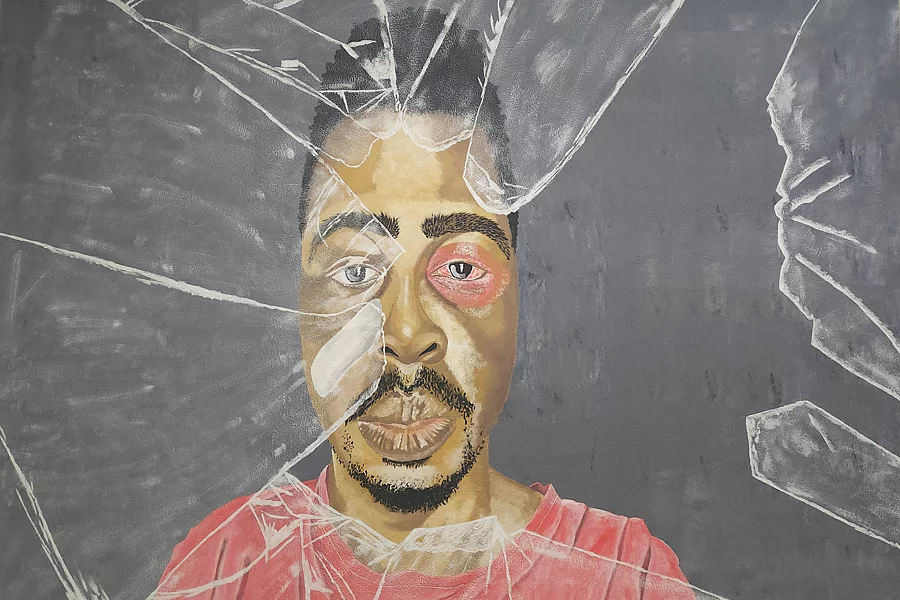 Portrait-style mural of a man wearing a pink/red shirt, looking directly at the viewer with a visibly bruised, reddened eye and a bandage on his forehead. The image is painted with a fractured, shattered-glass overlay effect across the face and background, giving a cracked or broken appearance. The mood is somber, rendered in muted grey tones apart from the skin and injury.